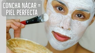 Elimina Cicatrices De Acne, Estrias y Aclarar La Piel Con Concha Nacar En 1 Semana