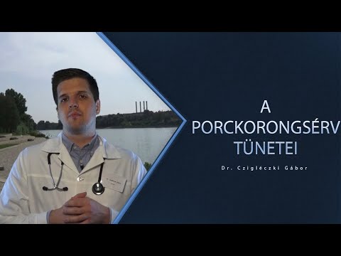 A porckorongsérv tünetei
