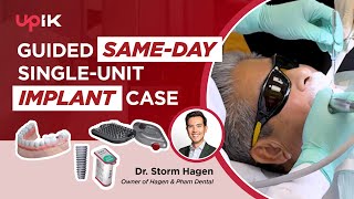 Guided Same-Day Single-Unit Implant Case with Dr. Storm Hagen