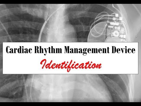 Cardiac Rhythm Management Device Identification