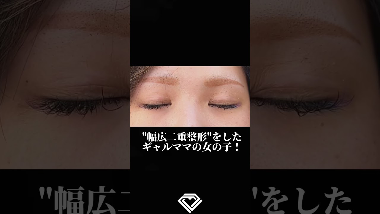 Youtubeのサムネイル