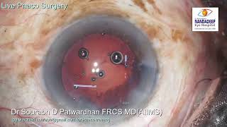 Acriol EC live streamed