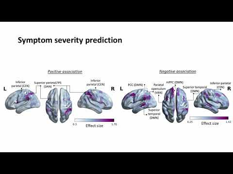 OHBM 2024 | Oral Session | Nga Yan Tse |  A mega-analysis of functional connectivity and network c…