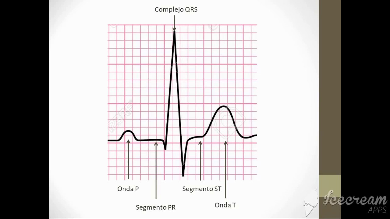 Electrocardiograma en 20 minutos Fisio UBA
