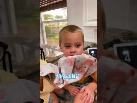 Ever heard of a sympathy bloody nose? Bryson had one today…