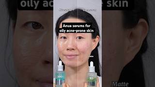 https://youtu.be/ZLNolTc6XNw?si=gqwcpIWgJGqzM3b0