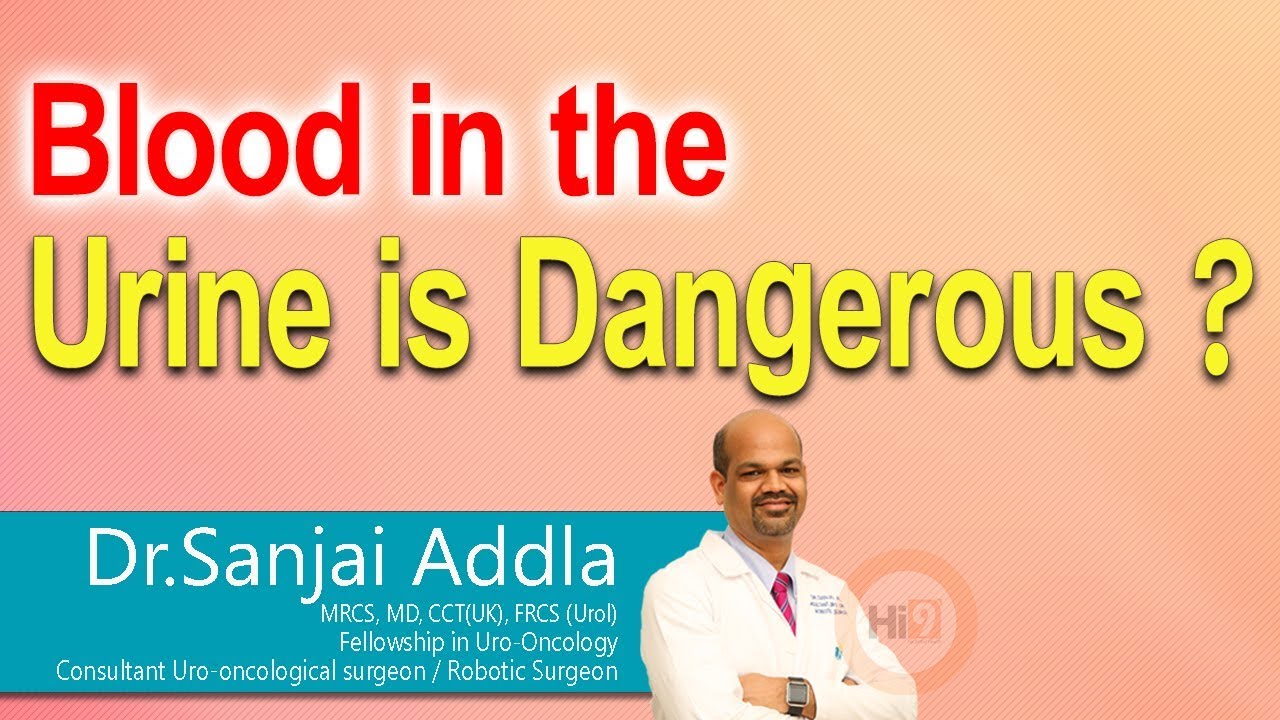 Hi9 | Blood in the Urine is Dangerous? | Hematuria | Blood cancer | Dr.Sanjai Addla | Uro oncologist