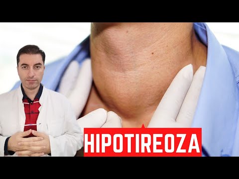 Da li imate USPORENI RAD ŠTITNJAČE ( HIPOTIREOZU)? Ovih 10 znakova će potvrditi bolest...