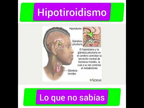 Lo que no sabias del hipotiroidismo