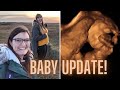 24 WEEKS PREGNANT Live Scan Footage AND Bump Shot Lesbian IVF Pregnancy UK