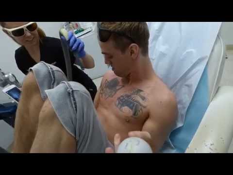 Aaron Carter Gets Tattoos Removed WITHOUT Numbing