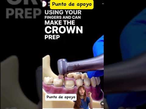 Puntos de apoyo en Odontología