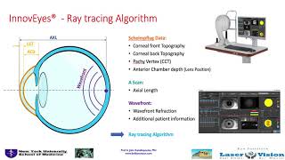 Download Lagu Initial Outcomes with Customized Myopic LASIK, Guided by Automated Ray Tracing Optimization Thumbnail