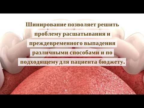 Шинирование зубов от стоматологии 'Корона'
