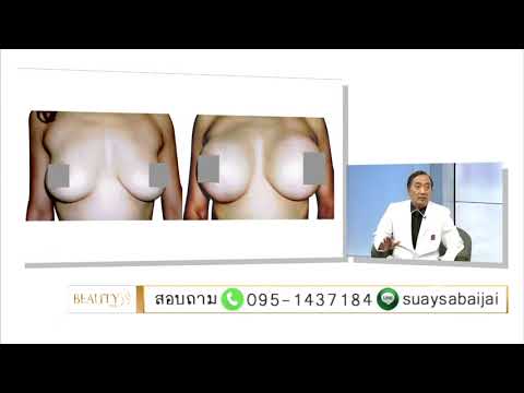 หัวนมขนาดใหญ่บนหน้าอกเล็ก ฮอร์โมนเพิ่มเต้านม