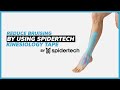 Bruising for Medical Professionals (Part 2) - SpiderTech