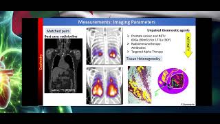 AICONM24 - Theranostics: Overview (F GIAMMARILE)