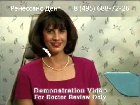 Виниры на зубы