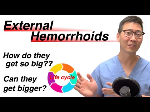 Life cycle of External Hemorrhoids! From baby to adult. | Dr. Chung explains!