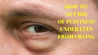 how to get rid of puffiness under eyes from crying
