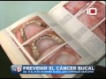 Video: Prevenir el cáncer bucal