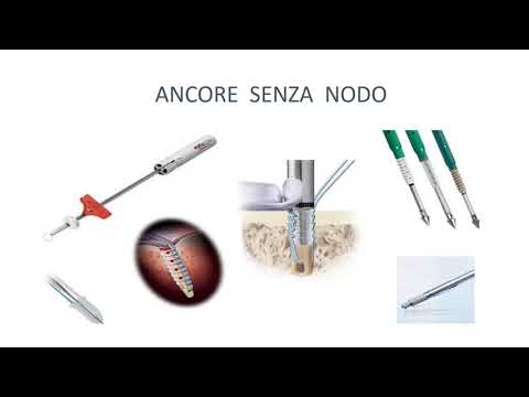 #14 - Cuffia dei rotatori, dalla "A" alla "P-rotesi": Knotless vs Knotted  - M.S. Tajana (Promo)