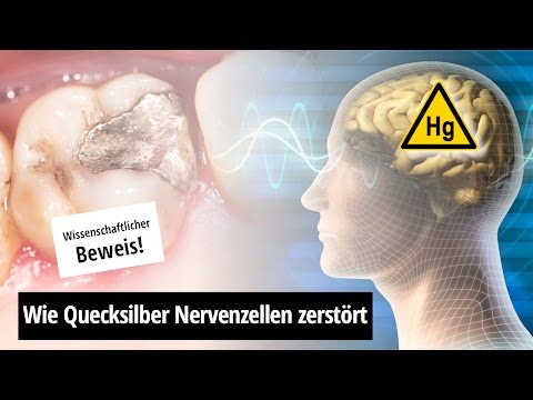 Amalgamentfernung: Nervengift Quecksilber (mit deutscher Übersetzung)
