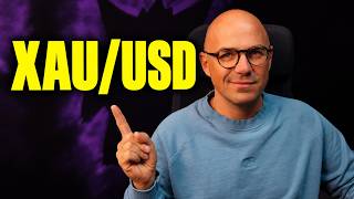 The Best Way to Trade Gold (XAU/USD)