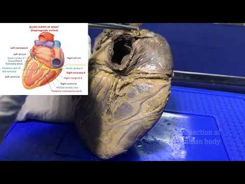 Blood supply of heart or Coronary circulation - Gross and clinical anatomy