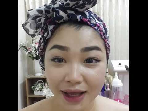 การบริโภค tar ไม้เรียวของโรคสะเก็ดเงิน Neurodermatitis รักษาได้เร็วขึ้น