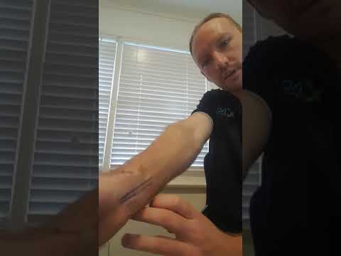 How to measure your radial pulse