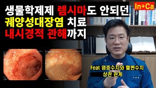 스테로이드 부작용과 올바른 사용법