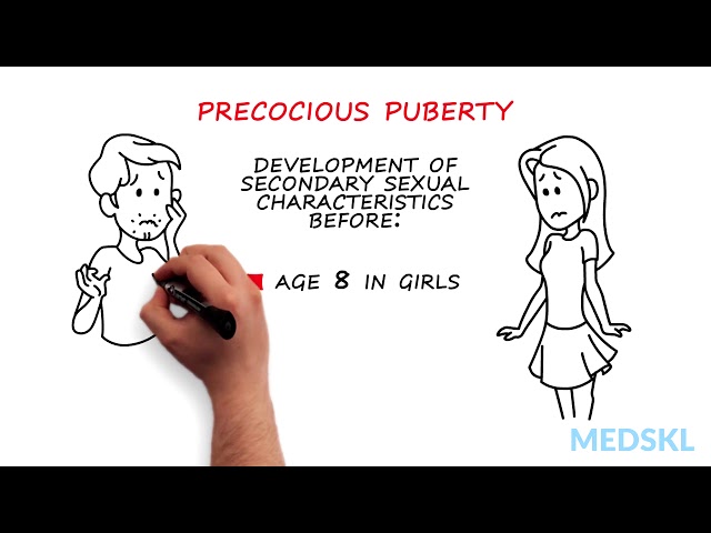 הגיית וידאו של pubertal בשנת אנגלית