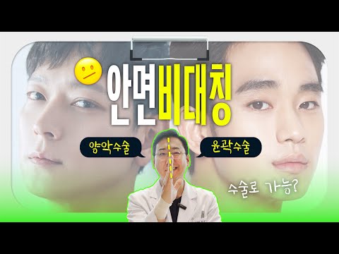 강동원도 김수현도 가지고 있는 그것.. 안면비대칭 해결방법은? (feat. 양악수술 vs 안면윤곽수술)