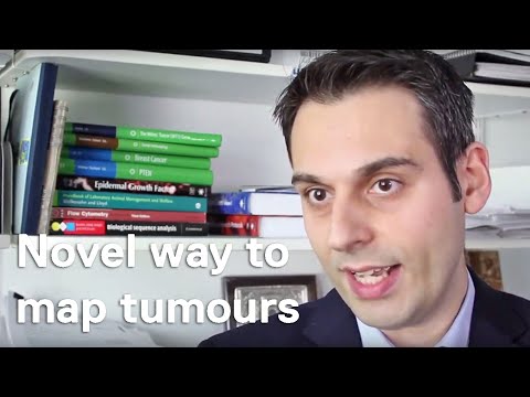 CRUK Grand Challenge award: Our role in research to map tumours in a completely novel way