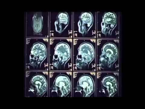 BIRD OF PREY FLC RMX-