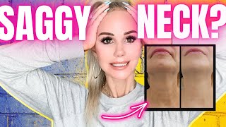 How to TIGHTEN a Saggy Neck (treatments for loose neck skin)