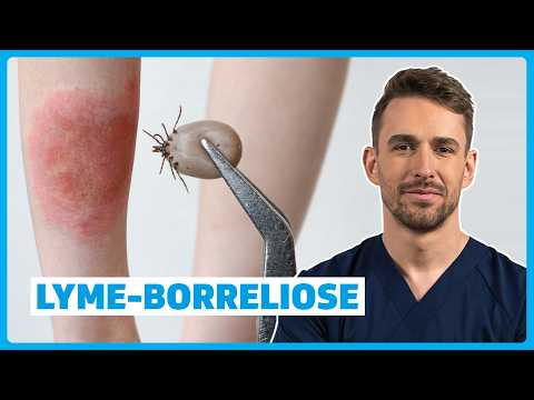 Lyme-Borreliose verstehen: Ursachen, Symptome, Diagnose & Therapie | DocTommy
