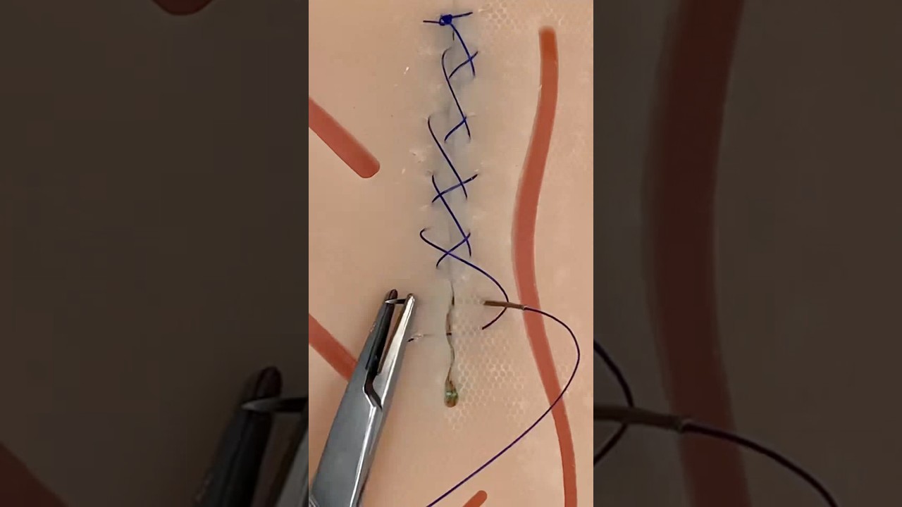 “Me dieron 80 puntos”, EXPLICO #suturas #veterinaria #medicamento #cirujana #datoscuriosos #cirugía