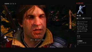 #7【アクションRPG】ウィチャー3 ワイルドハント プレイ動画(醜い赤ん坊)