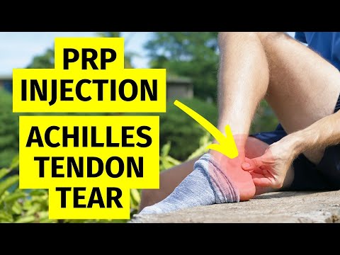 Platelet Rich Plasma (PRP) Injection for Achilles Tendon Tear