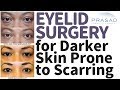 How Cosmetic Eyelid Surgery is Performed on Darker Skin While Avoiding Keloid Scars