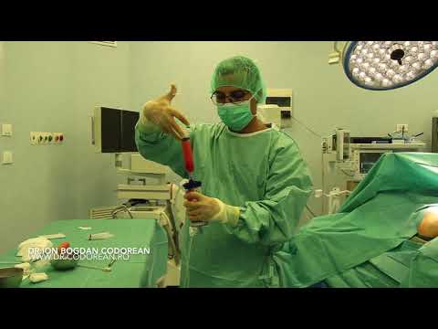 Stem cell harvesting — infiltrație genunchi