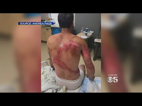 Family Survives Getting Struck By Lightning In Sequoia National Forest