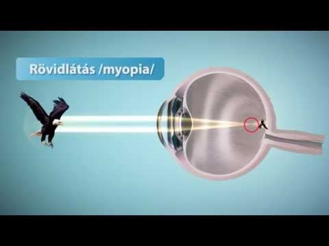 harcosok látás nélkül