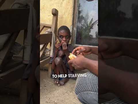 He travels to help feed starving children ❤️