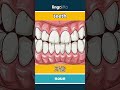 teeth - 牙齿 video thumbnail