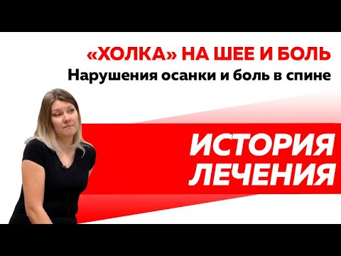 Отзыв Rekinetix. Избавление от "холки" и болей в спине