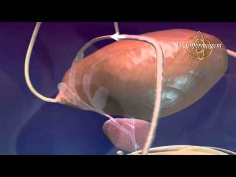 Sistema Reprodutor Masculino