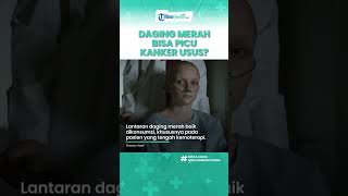 Benarkah Konsumsi Daging Merah Bisa Memicu Kanker Usus, Begini Penjelasan Dokter Ahli